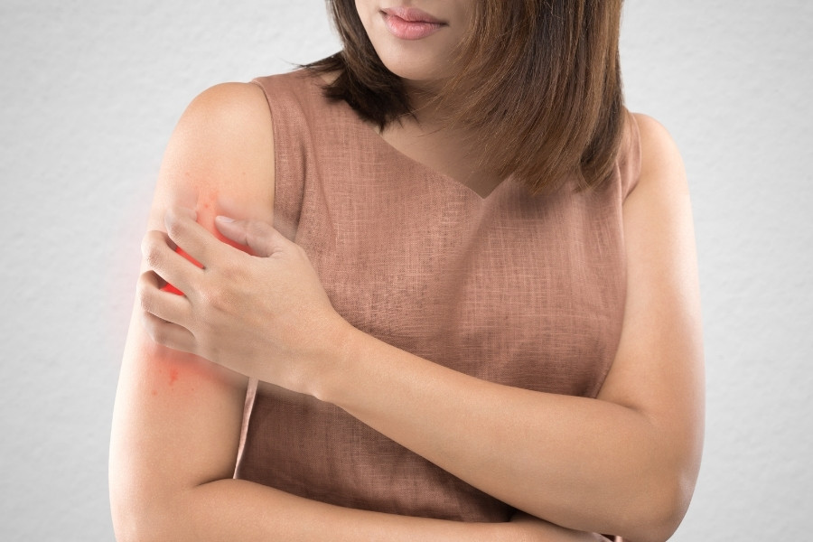 Dấu hiệu nhận biết dày sừng nang lông