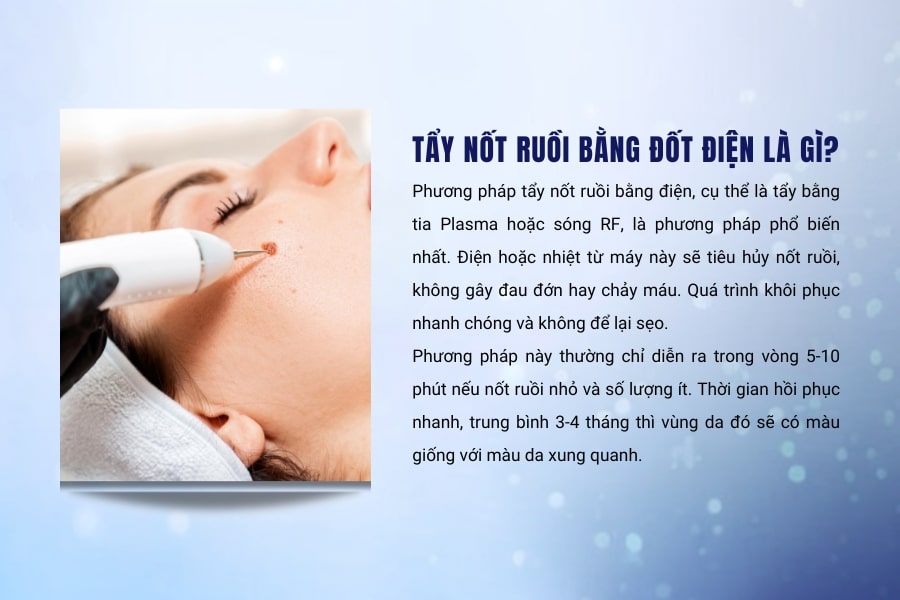 Đốt điện là phương pháp sử dụng tia plasma hoặc sóng RF để tẩy nốt ruồi