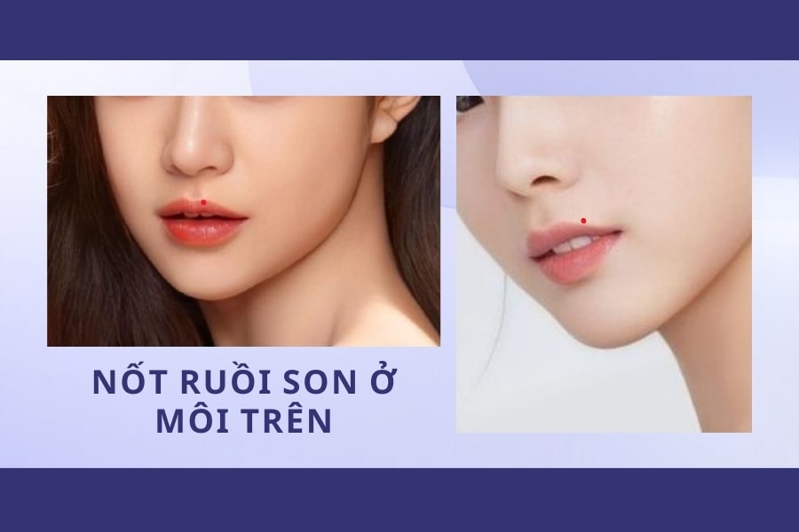 Mụn ruồi son môi trên - May mắn tiền tài, tình cảm phức tạp Mụn ruồi son môi trên - May mắn tiền tài, tình cảm phức tạp