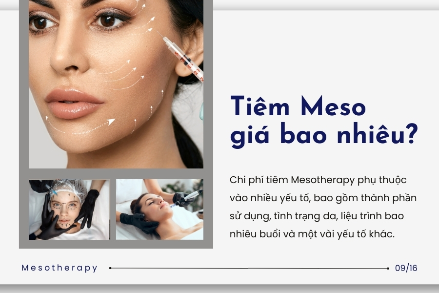 Tiêm Mesotherapy bao nhiêu tiền? Tiêm Mesotherapy bao nhiêu tiền?