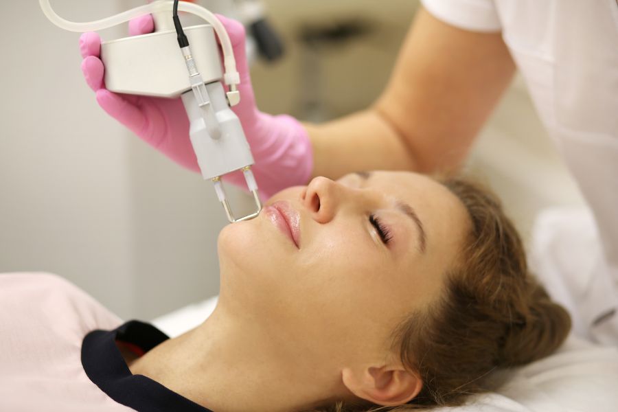 Điều trị sẹo rỗ bằng laser CO2 là công nghệ tiên tiến, mang lại độ chính xác cao