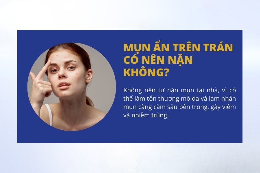 Mụn ẩn trên trán có nên nặn không? Cách hết mụn ẩn trên trán hiệu quả Mụn ẩn trên trán có nên nặn không? Cách hết mụn ẩn trên trán hiệu quả