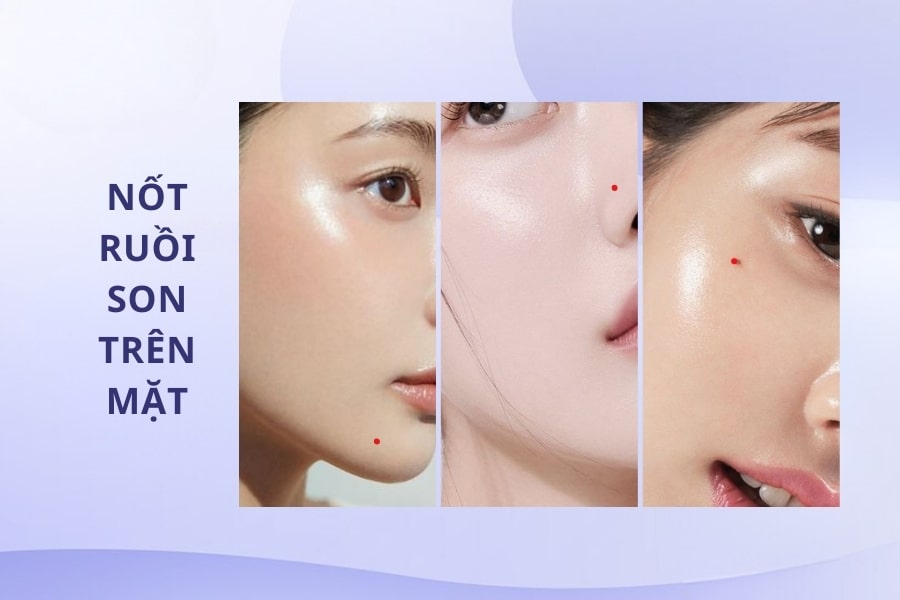 Có nốt ruồi đỏ trên mặt - Công danh, sự nghiệp phát triển Có nốt ruồi đỏ trên mặt - Công danh, sự nghiệp phát triển