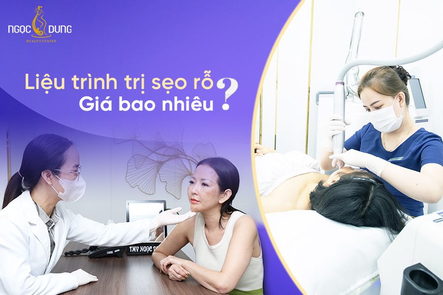 Liệu trình trị sẹo rỗ giá bao nhiêu? Hãy cùng chuyên gia tìm hiểu ngay