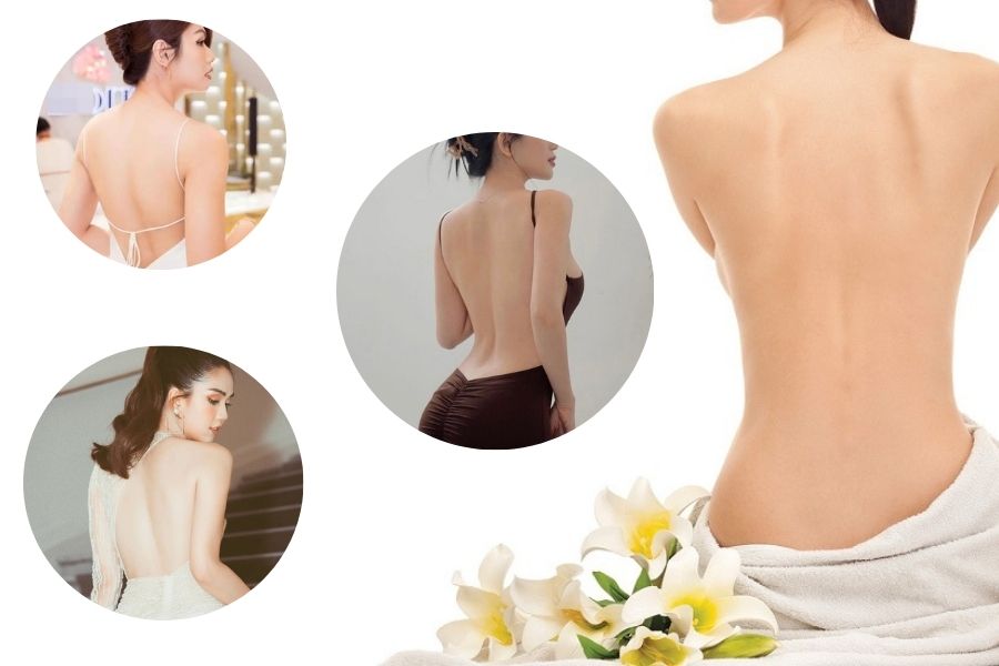 Lưng mịn màng sau khi triệt lông lưng