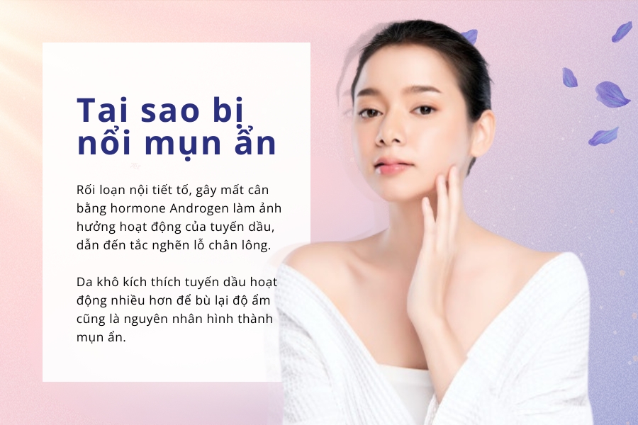 Tại sao mũi lại nổi mụn ẩn? Tại sao mũi lại nổi mụn ẩn?