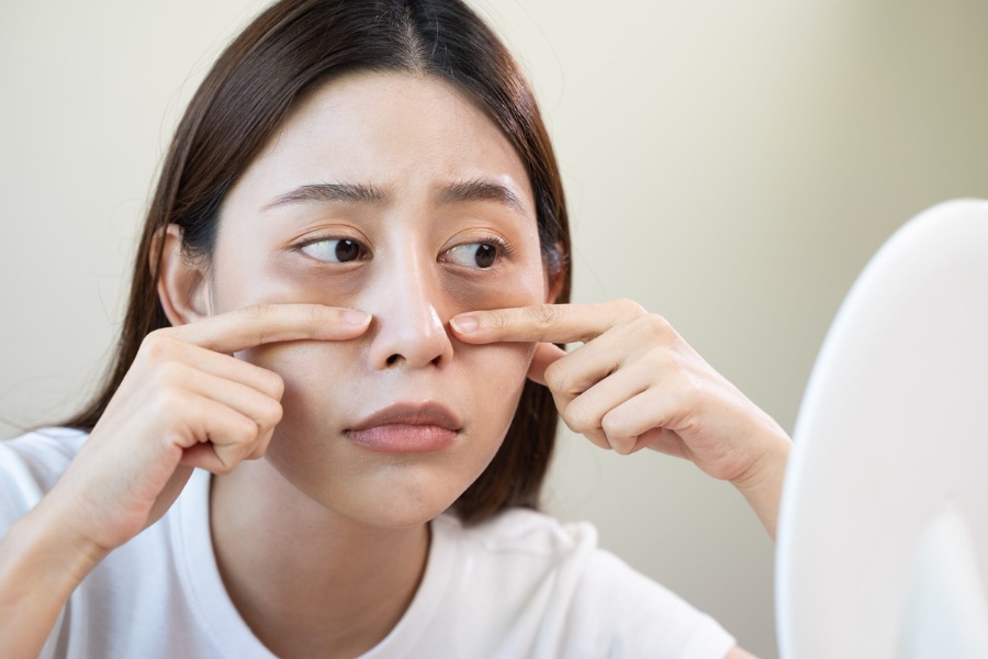 Thức khuya và thiếu ngủ khiến vùng da quanh mắt chùng nhão, thiếu sức sống Thức khuya và thiếu ngủ khiến vùng da quanh mắt chùng nhão, thiếu sức sống