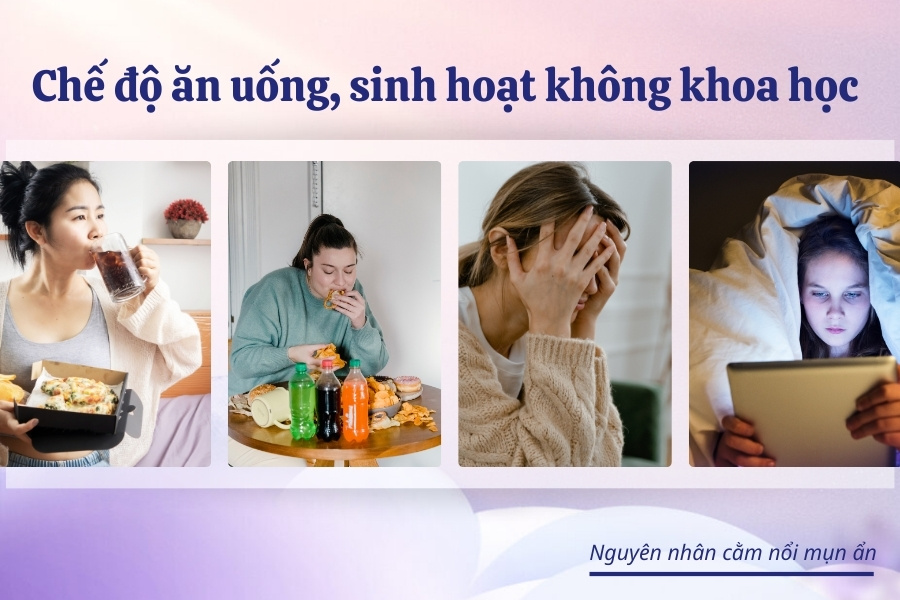 Chế độ ăn uống không khoa học và chế độ sinh hoạt không lành mạnh làm mụn ẩn dưới cằm xuất hiện Chế độ ăn uống không khoa học và chế độ sinh hoạt không lành mạnh làm mụn ẩn dưới cằm xuất hiện
