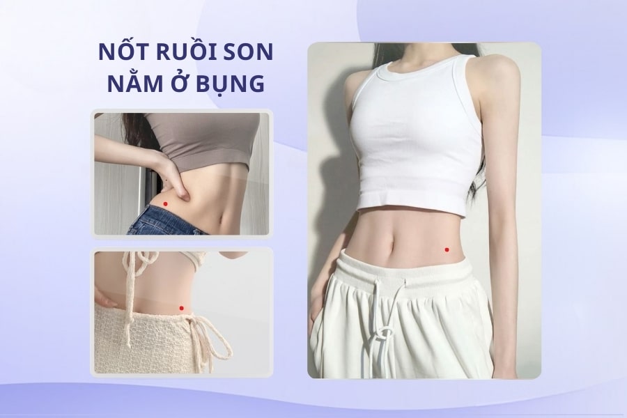 Ý nghĩa mụn ruồi son ở bụng phụ nữ Ý nghĩa mụn ruồi son ở bụng phụ nữ