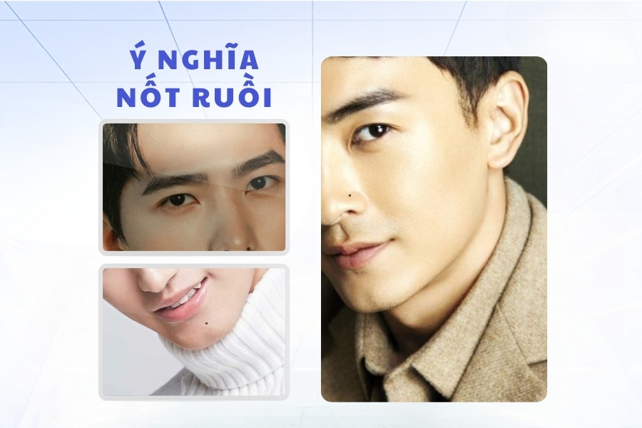 Ý nghĩa của những nốt ruồi trên mặt đàn ông