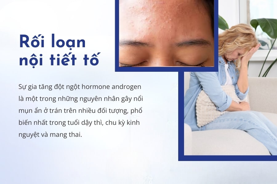 Thay đổi hormone cơ thể Thay đổi hormone cơ thể