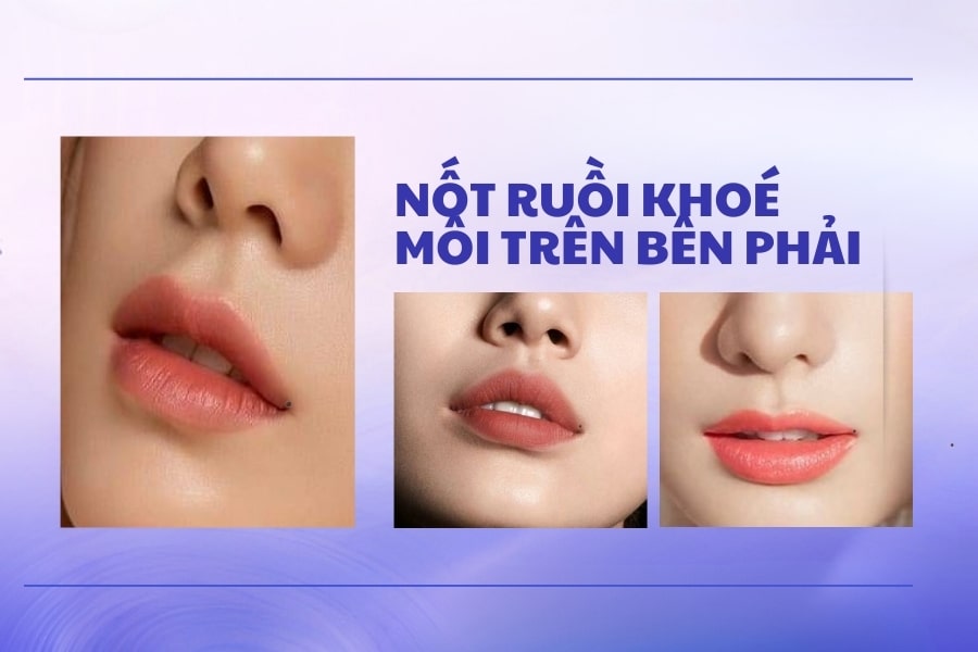 Nốt ruồi ở khóe môi trên bên phải là tốt hay xấu? Nốt ruồi ở khóe môi trên bên phải là tốt hay xấu?