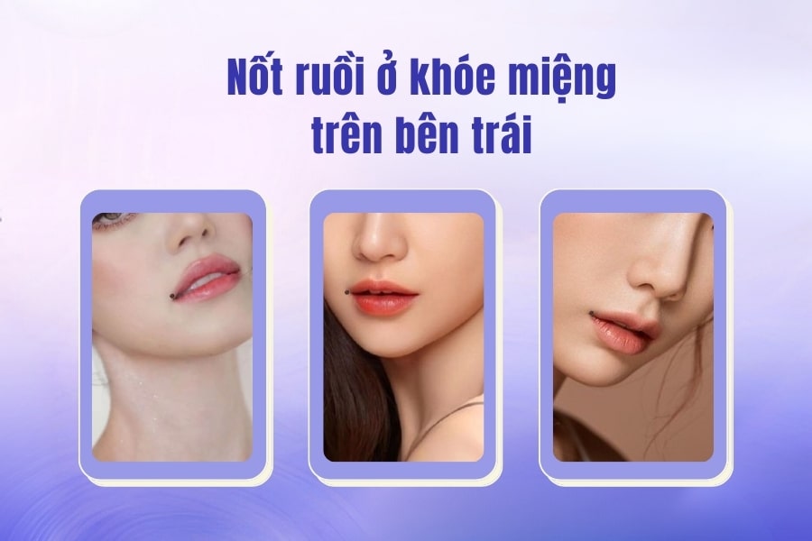 Ý nghĩa nốt ruồi ở miệng theo nhân tướng học Việt Nam 2 Nốt ruồi ở khóe miệng bên trái và bên phải theo nhân tướng học