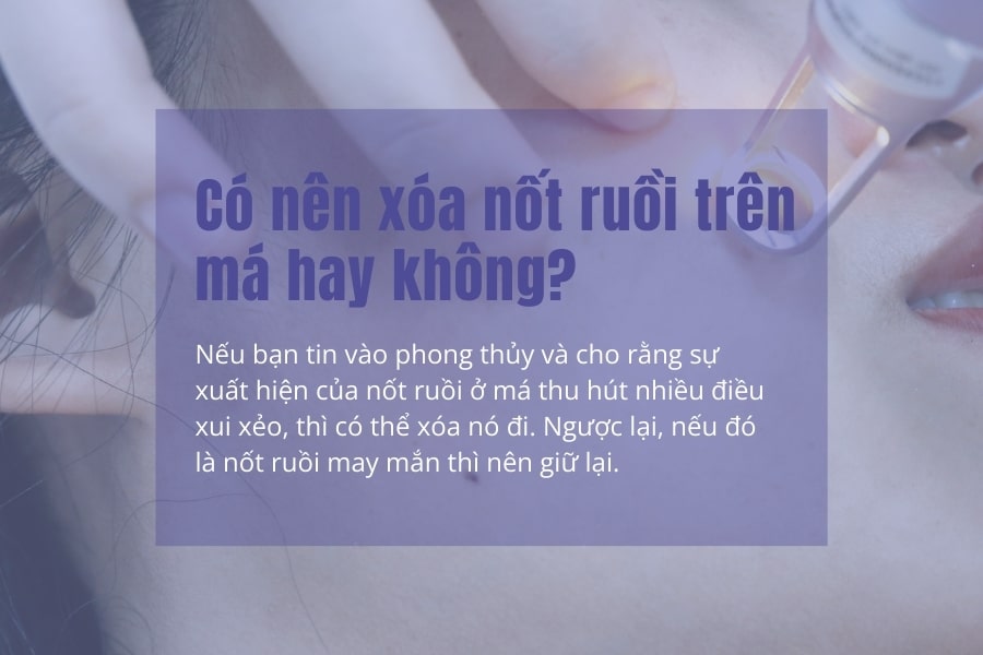 Xóa nốt ruồi trên má Có nên xóa nốt ruồi trên má hay không?