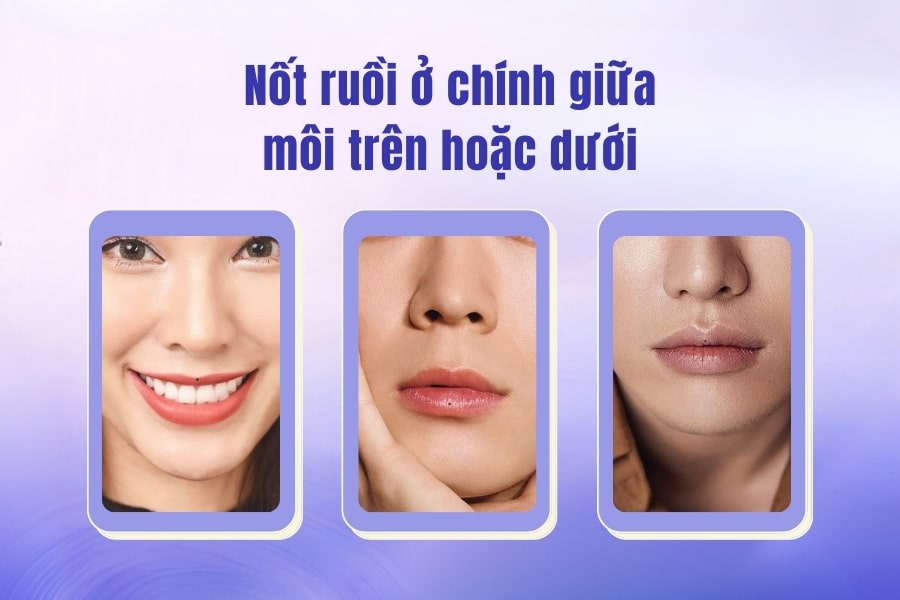 Vị trí nốt ruồi ở chính giữa môi trên hoặc dưới Vị trí nốt ruồi ở chính giữa môi trên hoặc dưới