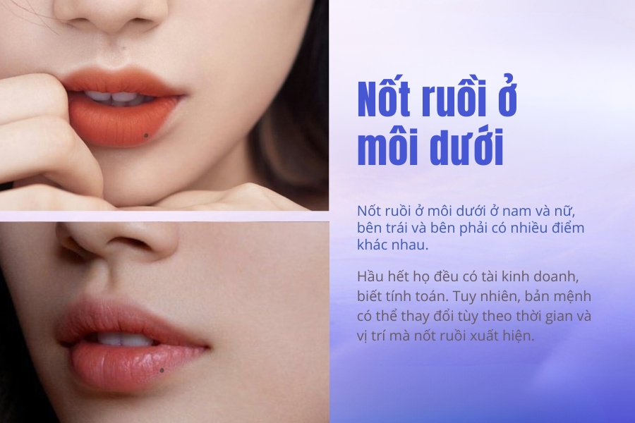 Ý nghĩa của nốt ruồi ở môi dưới nam và nữ Ý nghĩa của nốt ruồi ở môi dưới nam và nữ