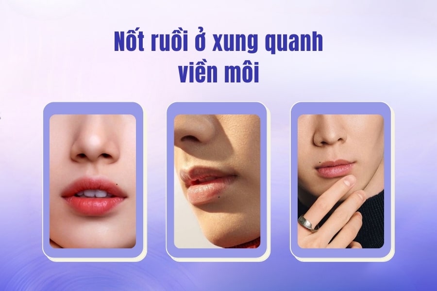Nốt ruồi ở viền môi trên có nên xóa không? Nốt ruồi ở viền môi trên có nên xóa không?