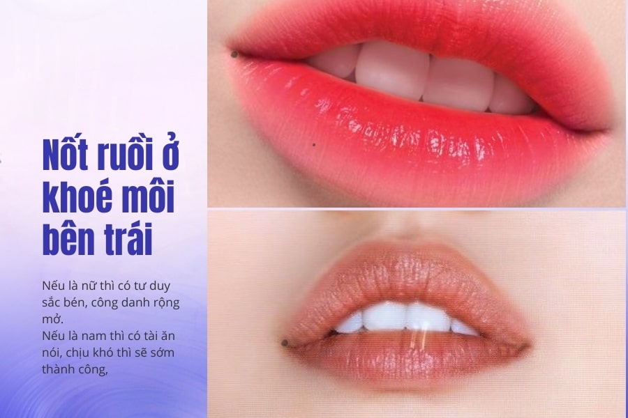 Nốt ruồi ở khóe môi bên trái có ý nghĩa gì? Nốt ruồi ở khóe môi bên trái có ý nghĩa gì?