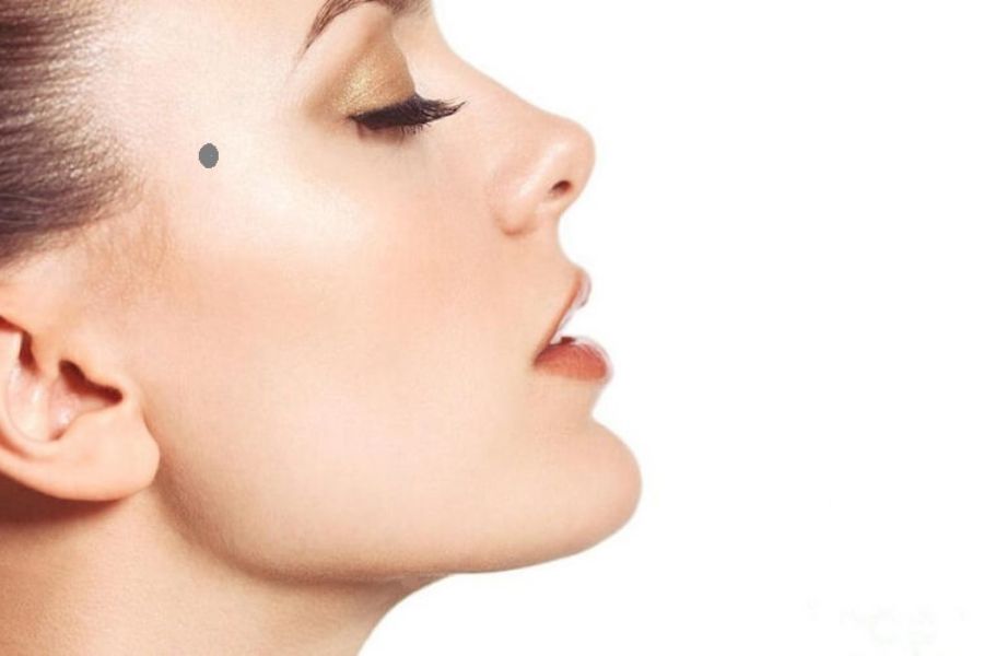 Nốt ruồi ở trán nam và nữ tốt hay xấu? Có nên tẩy không? 4 Nốt ruồi ở trán gần Thái Dương của phụ nữ là dấu hiệu của người thông minh, khéo léo từ sự nghiệp đến tình cảm