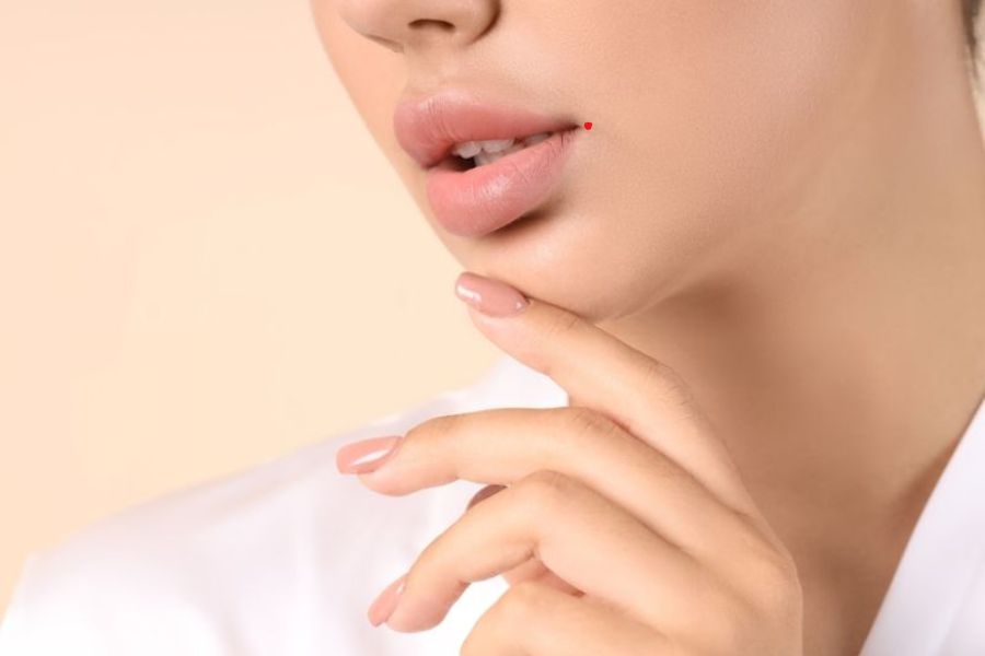 Nốt ruồi trên môi tốt hay xấu? Có nên tẩy mụn ruồi môi không? 6 Sự hài hước một cách duyên dáng khiến chủ nhân có nốt ruồi ở khóe môi nhận được sự yêu mến của mọi người