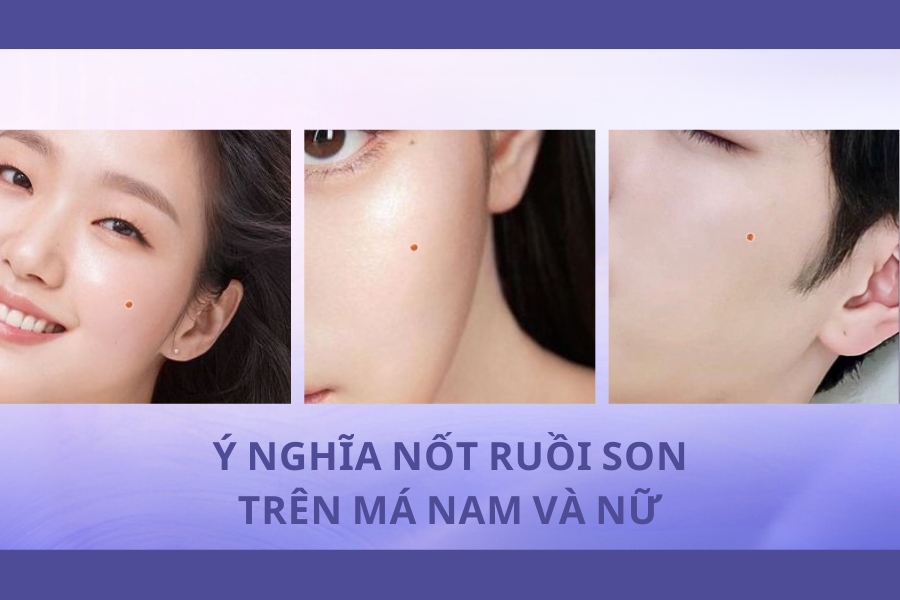 Nốt ruồi son trên má Ý nghĩa nốt ruồi son trên má nam và nữ