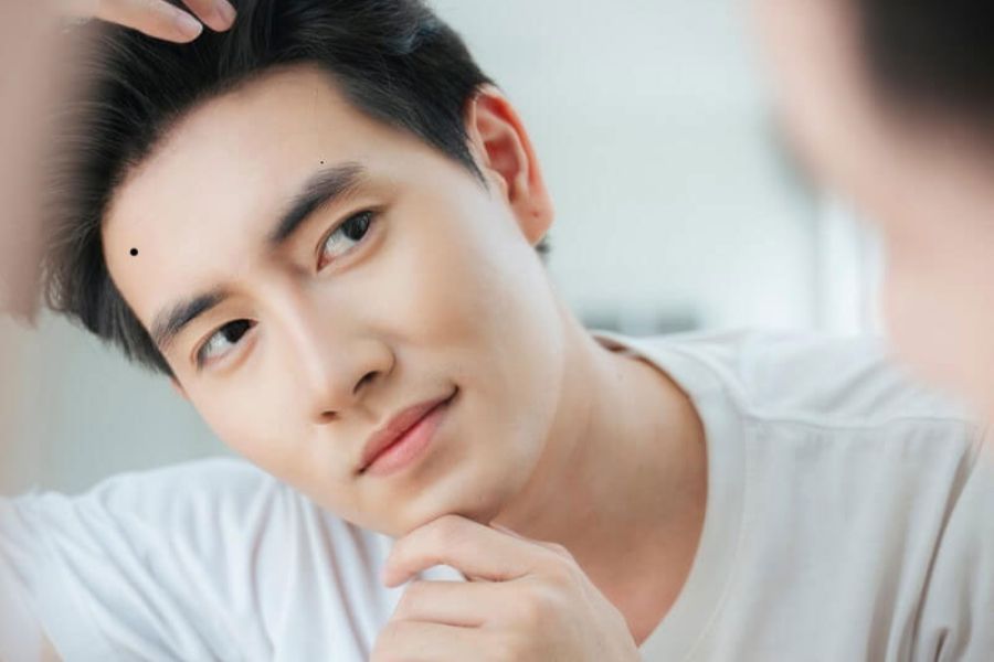 Nốt ruồi ở trán nam và nữ tốt hay xấu? Có nên tẩy không? 7 Đàn ông có nốt ruồi gần thái dương may mắn trong sự nghiệp, nhưng tình duyên có phần trắc trở