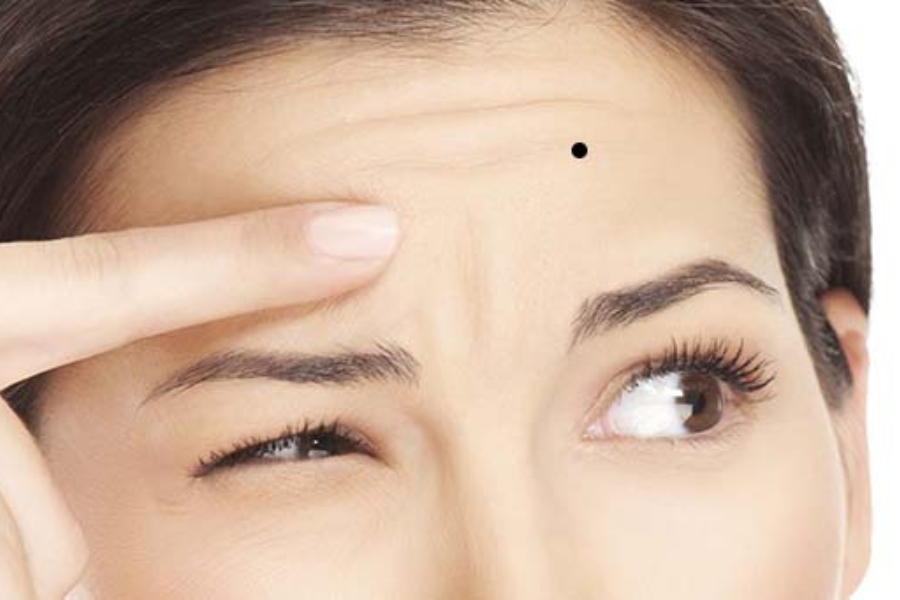 Nốt ruồi trên trán - Kiểu phụ nữ bản lĩnh, nhưng lận đận tình duyên