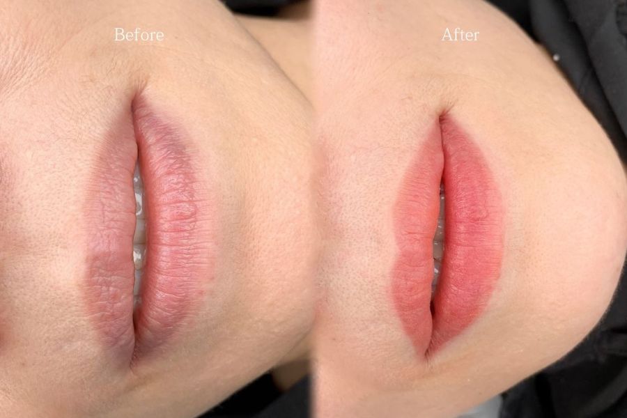 Sự kết hợp giữa công nghệ tiên tiến và đội ngũ chuyên gia chuyên nghiệp, Ngọc Dung đã mang lại những kết quả ấn tượng cho hàng ngàn khách hàng