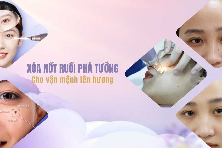 Tẩy nốt ruồi bằng laser ở đâu uy tín, an toàn và không để lại sẹo?