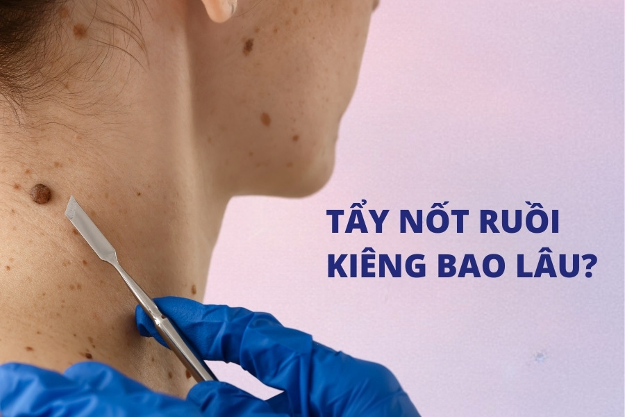 Theo lời khuyên của nhiều chuyên gia, 1 tuần sau khi xóa nốt ruồi là khoảng thời gian bạn tuyệt đối không nên ăn các loại thực phẩm như rau muống, đồ nếp, thịt bò,..