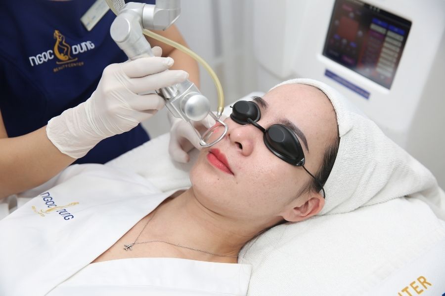 Tẩy/xóa nốt ruồi nhanh chóng bằng công nghệ cao tại Ngọc Dung Beauty