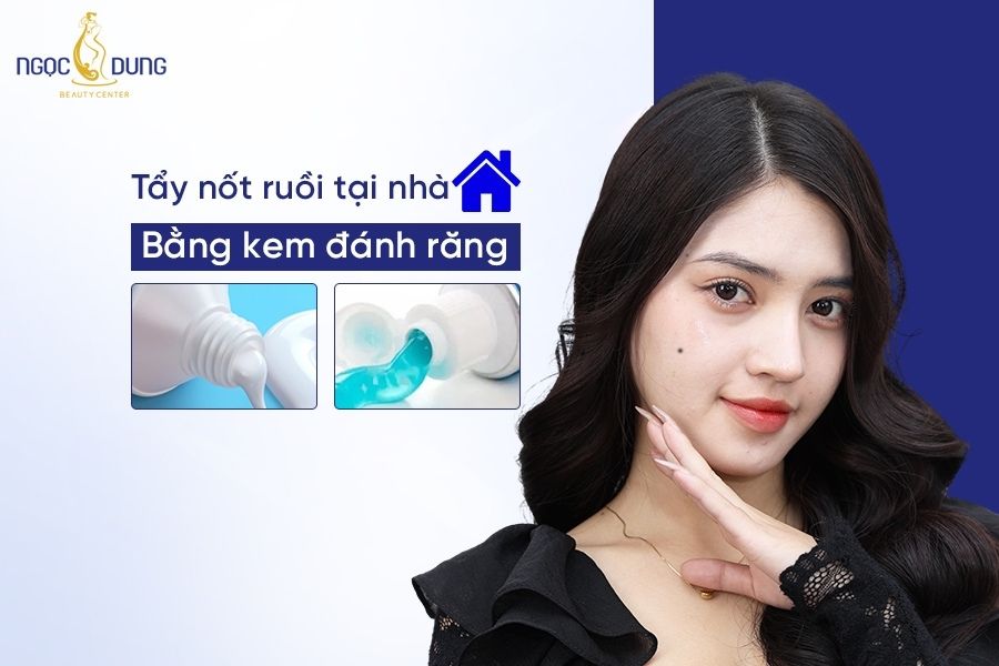 “Bật mí” các cách tẩy nốt ruồi tại nhà bằng kem đánh răng cực đơn giản mà có thể bạn không biết