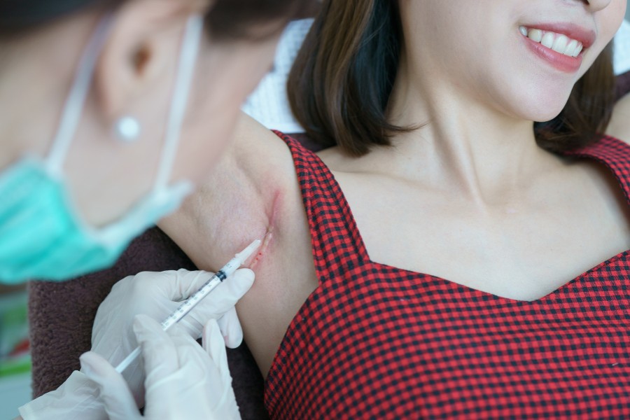 Tại sao sẹo lồi ngày càng to? Cách trị sẹo lồi lan rộng hiệu quả 11 width=