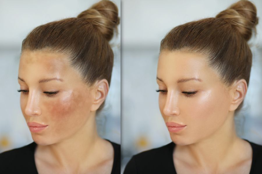 Dưa hấu có chứa glutathione đây là loại hợp chất chống oxy hóa giúp làm da trở nên sáng và mịn màng Dưỡng chất trong dưa hấu hỗ trợ làm sáng da