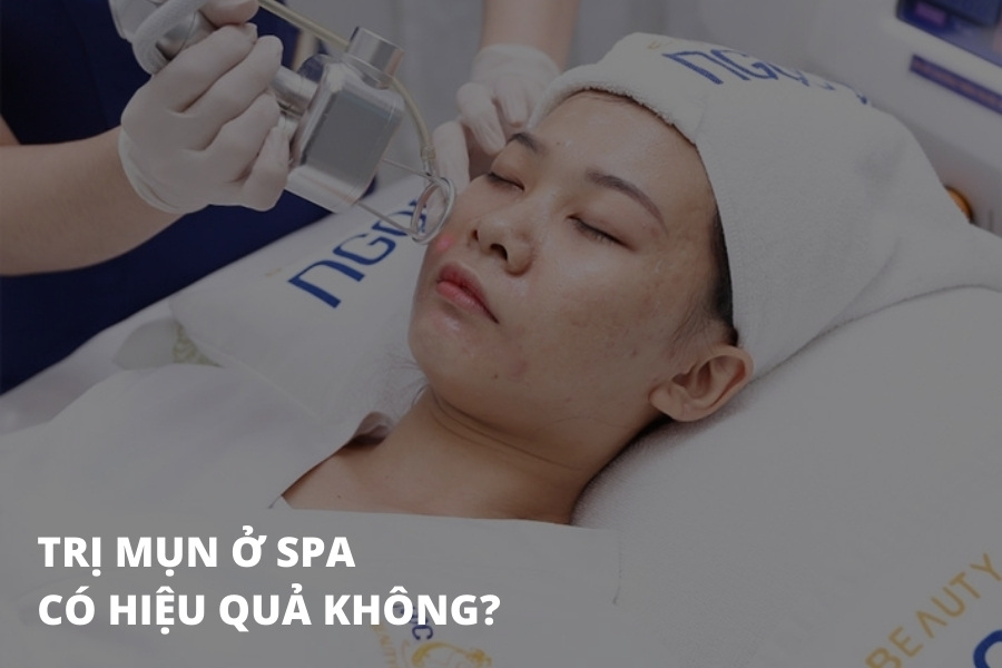 Giải đáp: trị mụn ở Spa có hiệu quả không?