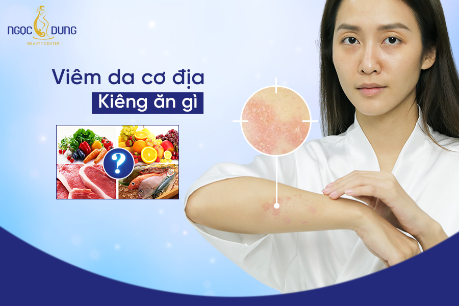 viem da co dia kieng an gi