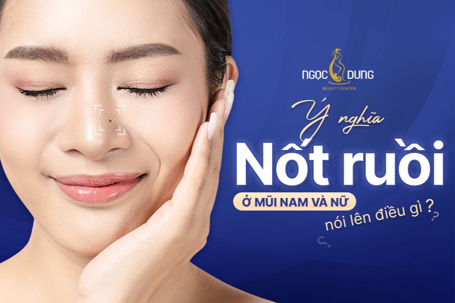 Ý nghĩa nốt ruồi ở mũi nam, nữ nói lên điều gì?