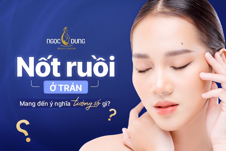 Nốt ruồi ở trán nam và nữ tốt hay xấu? Có nên tẩy không? 2 Nốt ruồi ở trán của cả nam và nữ mang những ý nghĩa gì?