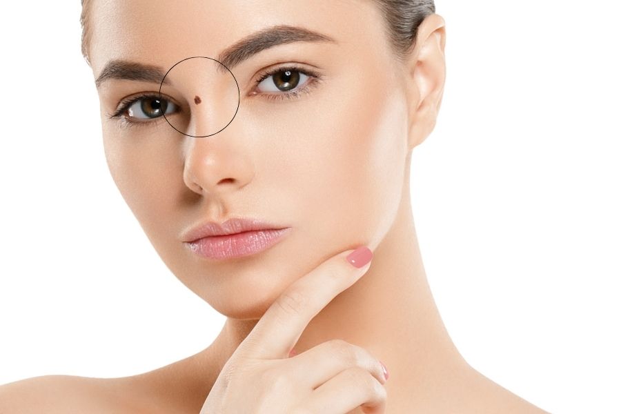 Sơn căn là vị trí nằm dưới ấn đường, nằm giữa hai mắt, và là vị trí cao nhất của sống mũi Sơn căn là vị trí nằm dưới ấn đường, nằm giữa hai mắt, và là vị trí cao nhất của sống mũi