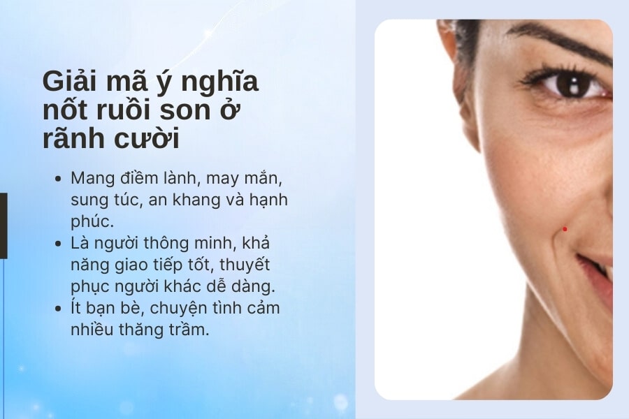 Nốt ruồi ở rãnh cười là nốt ruồi son sẽ mang đến nhiều may mắn cho chủ nhân