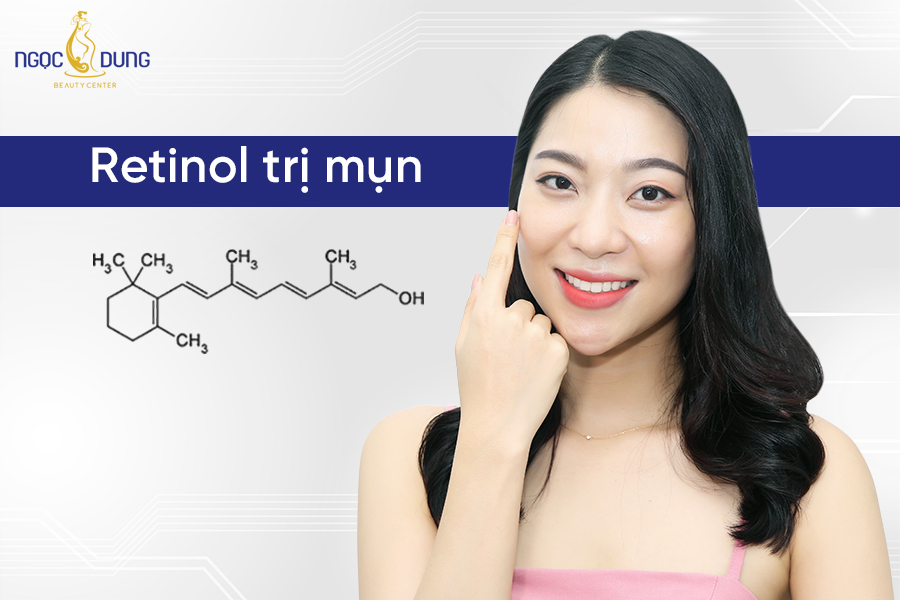 Retinol có trị mụn không? Cách trị mụn bằng Retinol