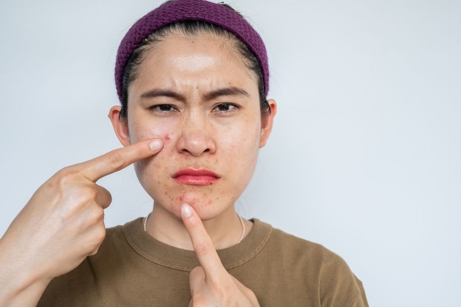 Nếu viêm lỗ chân lông ở mặt được điều trị kịp thời và đúng cách, làn da có thể hồi phục hoàn toàn