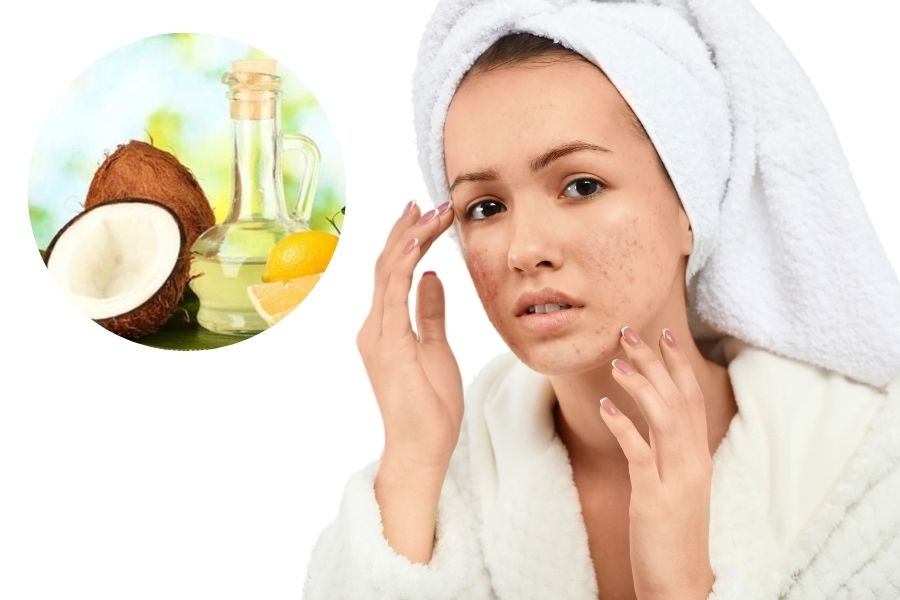 Dầu dừa và chanh có khả năng diệt khuẩn, nuôi dưỡng cho da thêm mềm mại