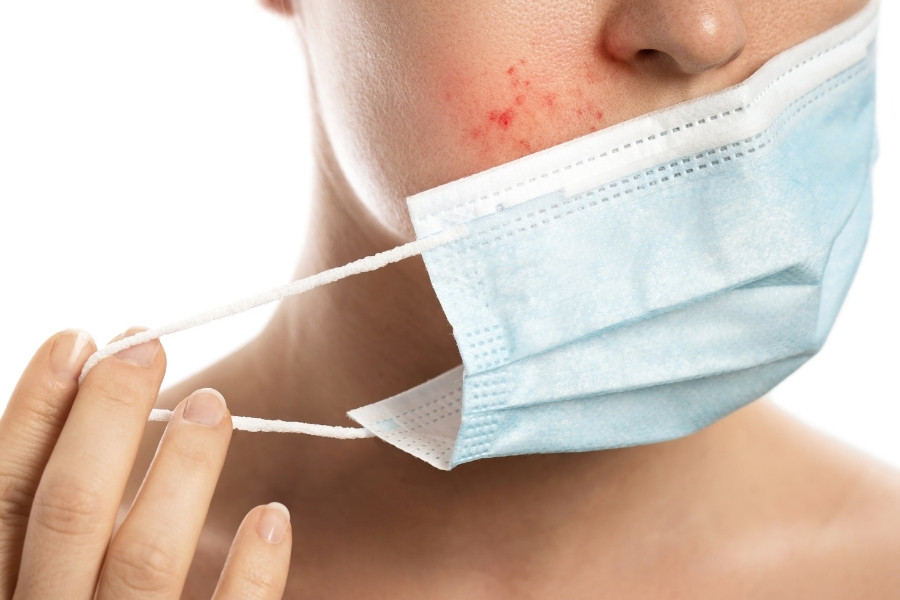 Việc sử dụng kem tẩy lông không đúng cách có thể gây chảy máu lỗ chân lông