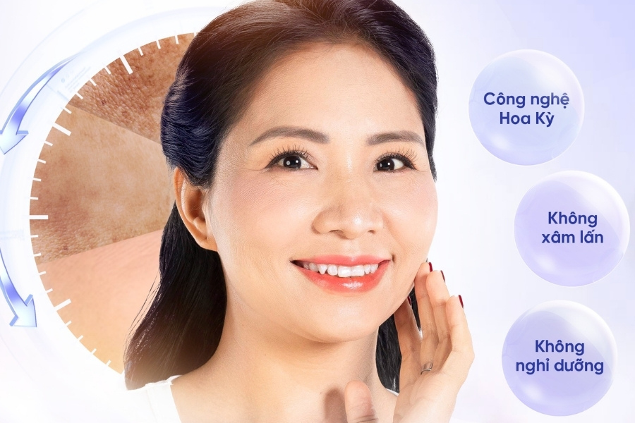 Đánh bật sạm nám với siêu công nghệ laser tại TMV Ngọc Dung