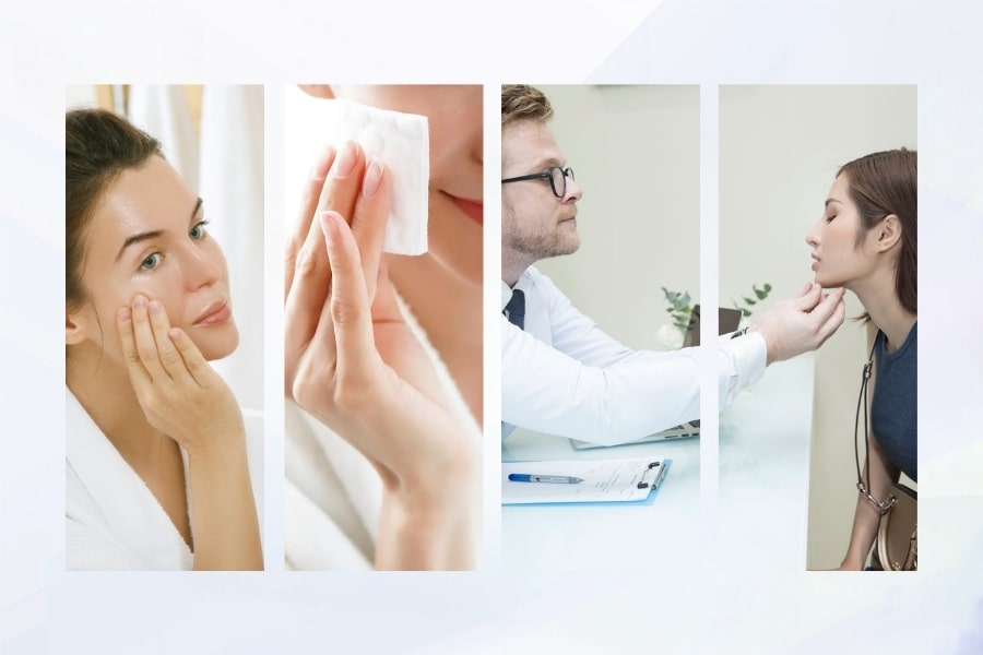 Cần làm gì khi làn da bị gây hại bởi rượu thuốc trị mụn? Cần làm gì khi làn da bị gây hại bởi rượu thuốc trị mụn?