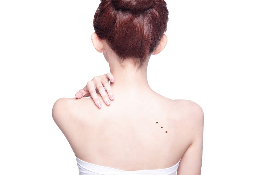 Đây là nốt ruồi phú quý, cuộc sống luôn được quý nhân phù trợ