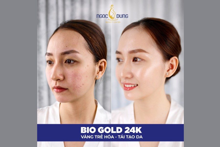 Công nghệ trẻ hóa da độc quyền tại TMV Ngọc Dung đã được nhiều khách hàng tin chọn Công nghệ trẻ hóa da độc quyền tại TMV Ngọc Dung đã được nhiều khách hàng tin chọn