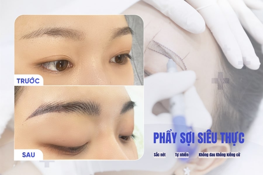 Thẩm mỹ phun xăm chân mày khắc phục khuyết điểm chân mày thưa Thẩm mỹ phun xăm chân mày khắc phục khuyết điểm chân mày thưa