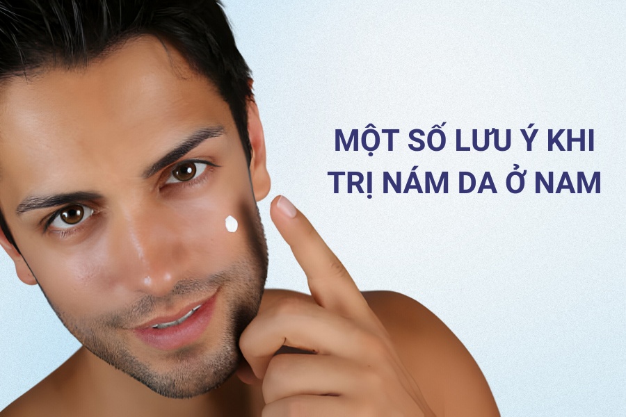 Một số lưu ý khi trị nám da ở nam giới Một số lưu ý khi trị nám da ở nam giới